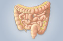 Síndrome do intestino curto